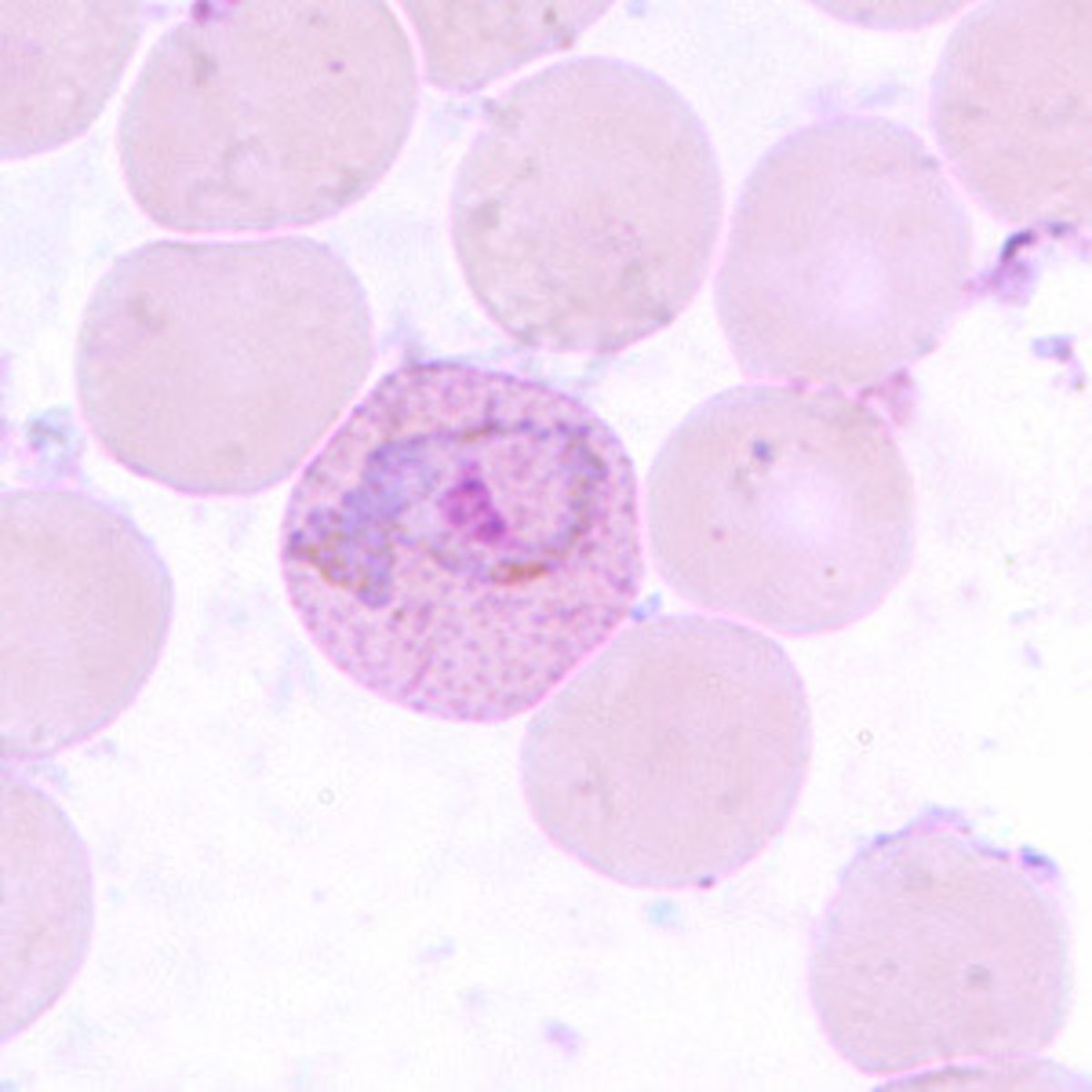 <p>molding, larger infected RBC, Schuffner's dots</p>