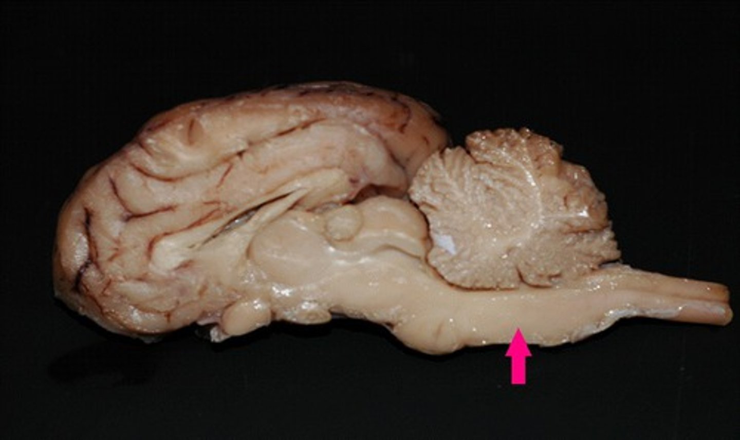 <p>Most posterior of brain regions</p><p>Composed of:</p><p>-Large tracts carrying signals bw rest of brain</p><p>-Reticular Formation</p><p>-Role in sleep, arousal, attention, movement, muscle tone, reflexes</p>