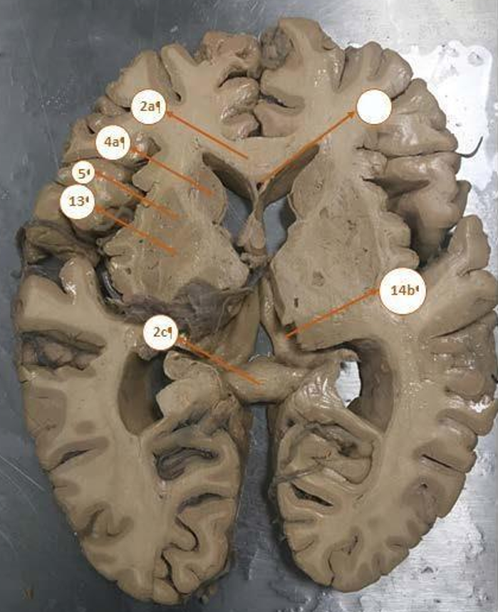 <p>14</p>