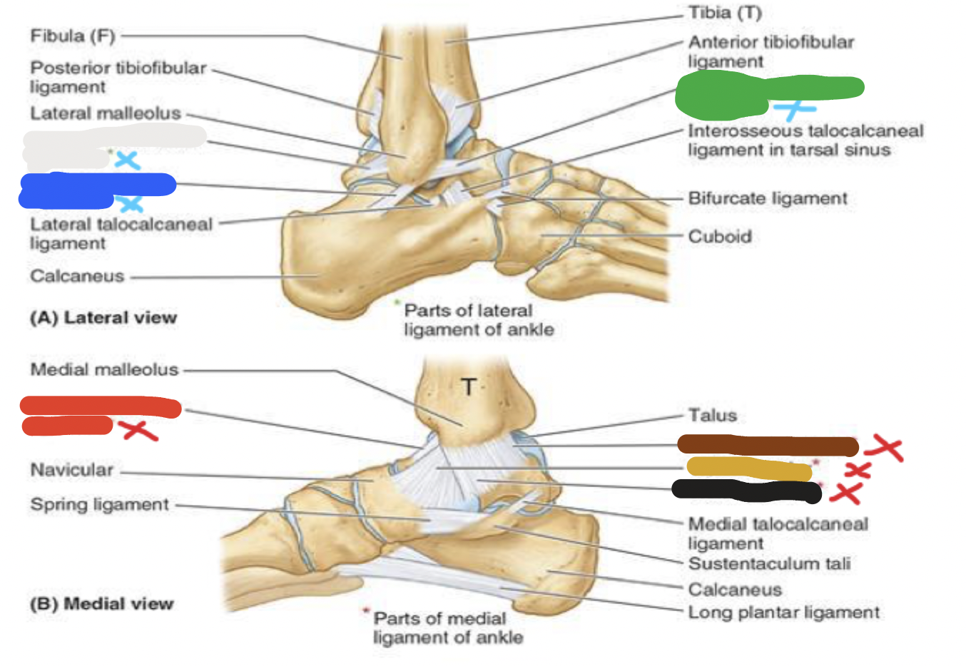 <p>joint: red</p>
