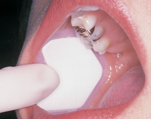 <p>what is this dental instrument called?</p>