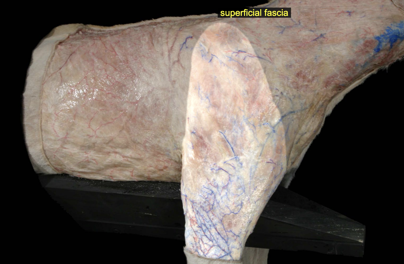 <p>Superficial fascia</p>