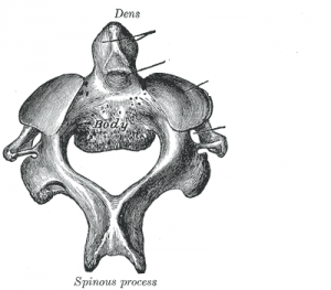 <p><span>It possesses a large odontoid process (dens axis) which is attached to the superior surface of its body</span></p>