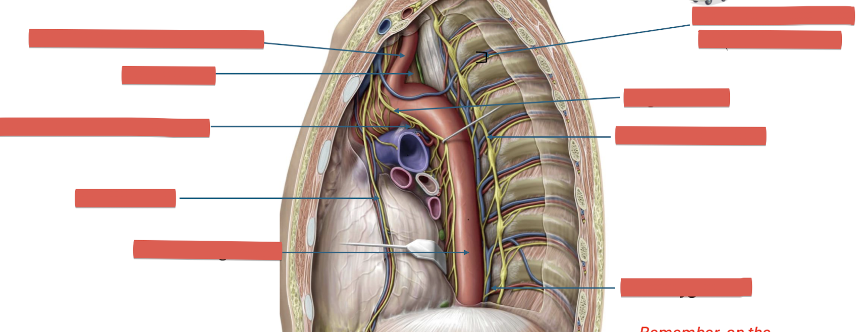 <p>Fill in the blank - RED side (left) </p>