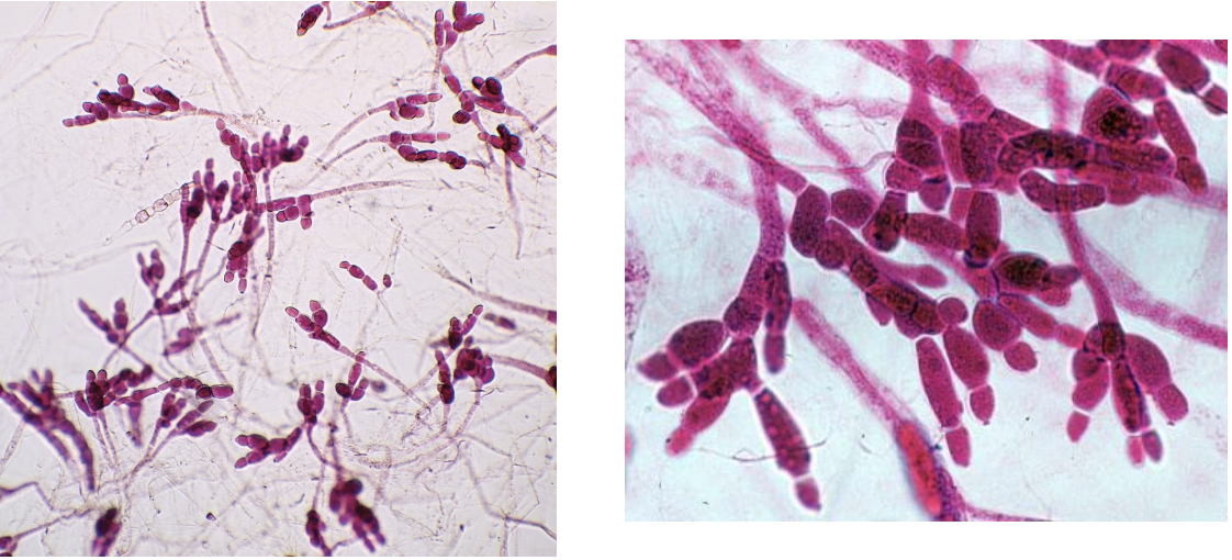 <p>What group/category of fungi is this in?</p>
