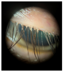 <p>Describe these ABNORMAL findings (Assume OD)</p>