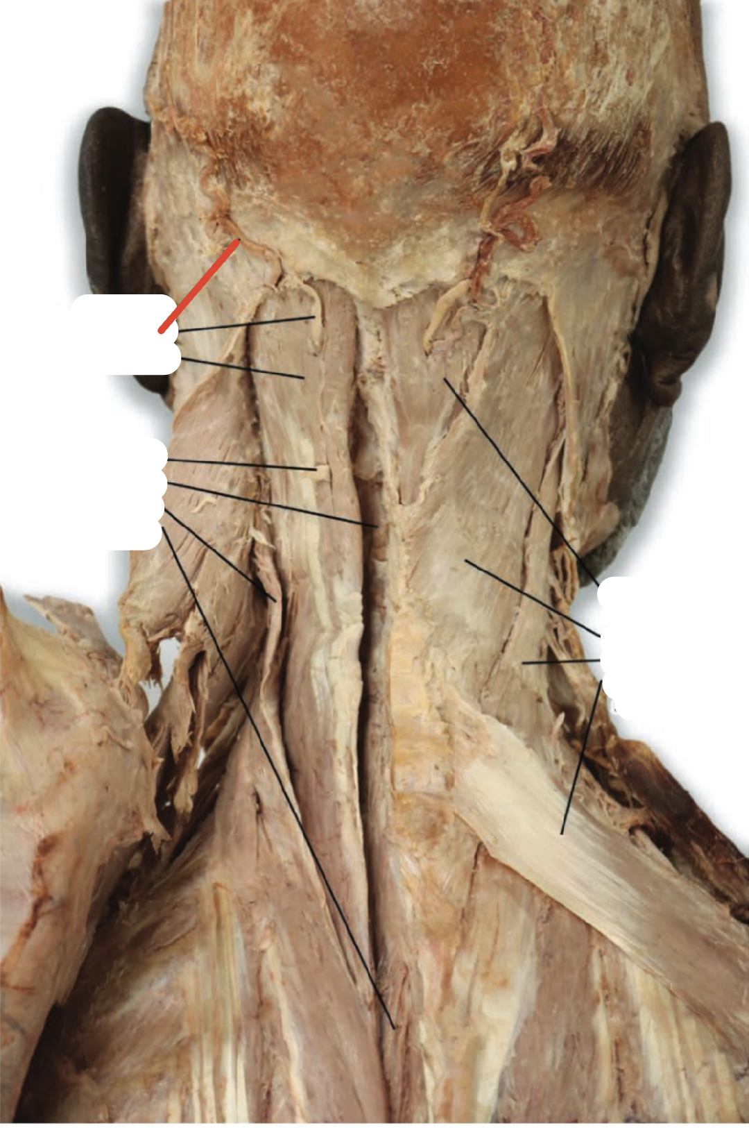 Identify the structure (red line)