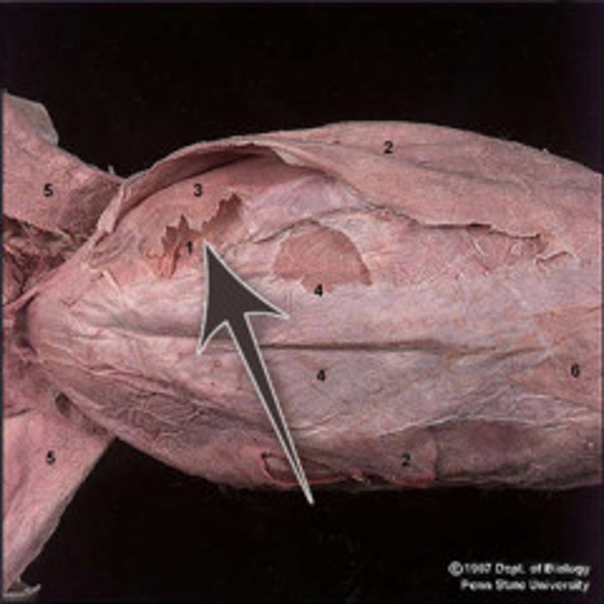 <p>name this muscle</p>