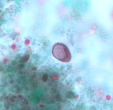 <p>Professor: Dr. Glena Fe A. Yapchulay-Alcabasa</p>