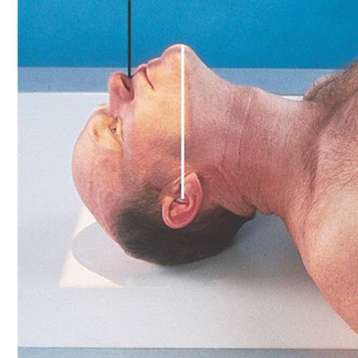 <p>What is this projection?</p><p>How is Patient positing?</p><p>What is the CR?</p><p>What are the structures shown?</p>