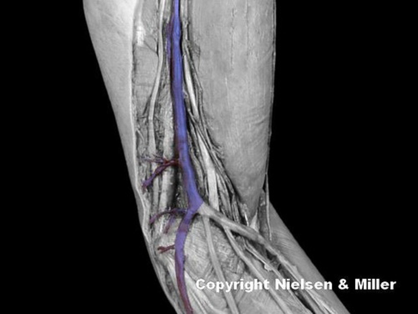 <p>Identify the regions drained by the highlighted vessel (anteromedial view of superficial veins of arm/forearm).</p>