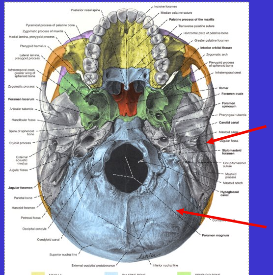 <p>What is the top arrow?</p>