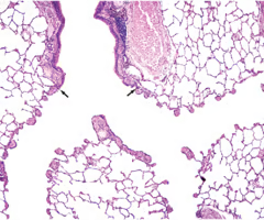 <p>Cuboidal ciliated columnar epithelium with interspaced club cells </p><p>Sparse smooth muscle layer</p><p>lack cartilage</p>