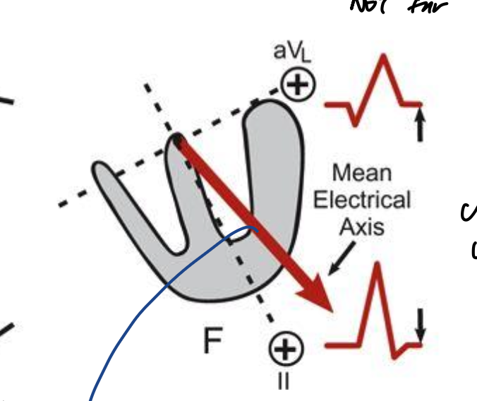 <p><strong>The Electrocardiogram</strong></p><p>What is happening here?</p>