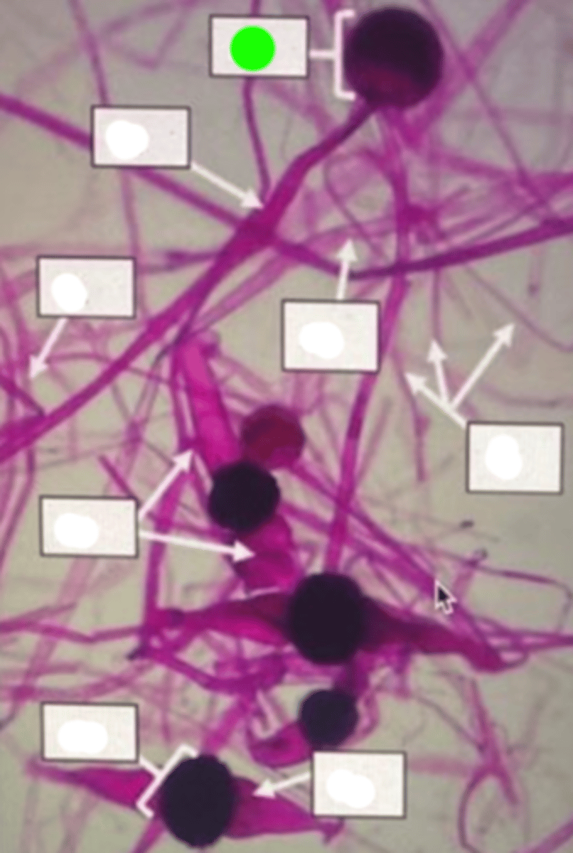 <p>Structure within which spores are produced and stored before release.</p>