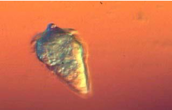 <ul><li><p>cercariae = infective stage (terror worm)</p></li><li><p>miracidium = released from egg &amp; infects intermediate host (second pic)</p></li></ul><p></p>