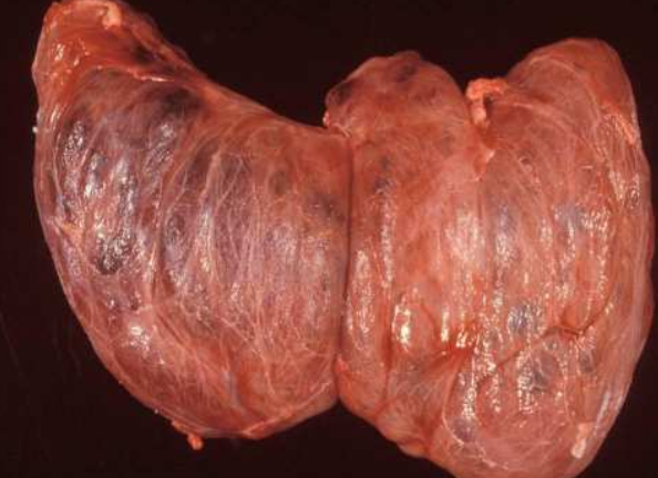 <p>What organ is visible and what is wrong?</p>