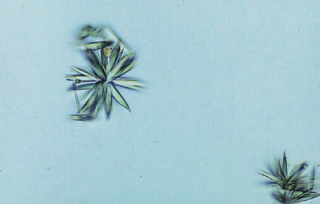 Sulfonamide crystals in rosette forms