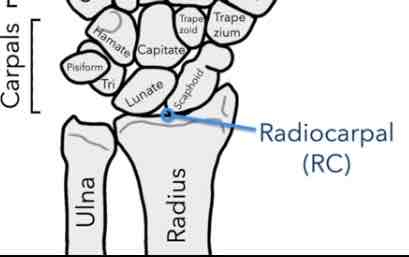 <p>Between the radius and scaphoid, lunate and triquetrum.</p>