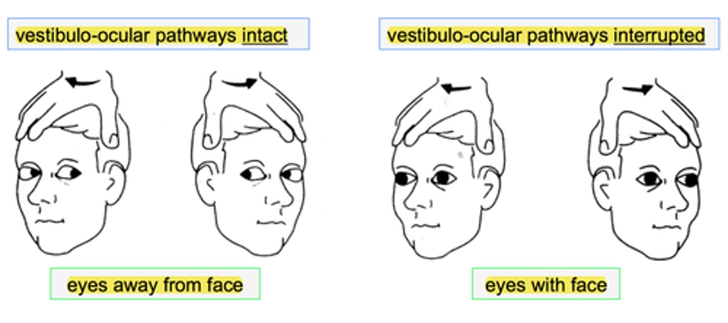 <p>infant's head is turned and eyes stay fixed with lag time before adjusting → present from birth to 3-4 months</p>