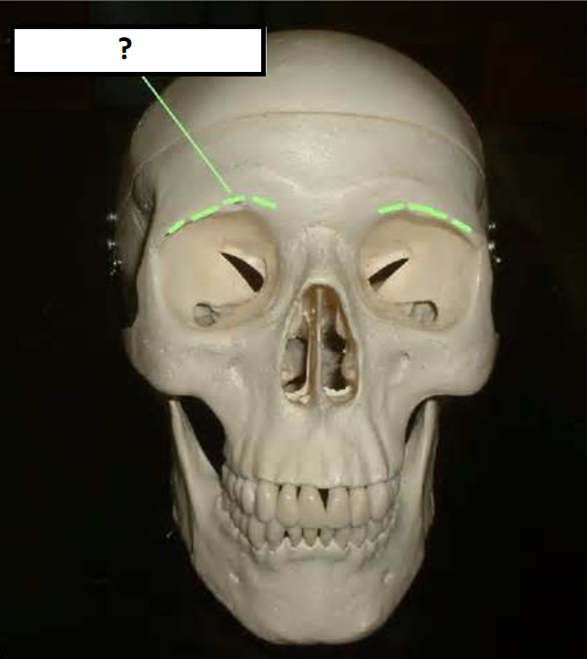 <p>Which frontal bone marking is this? (2)</p>