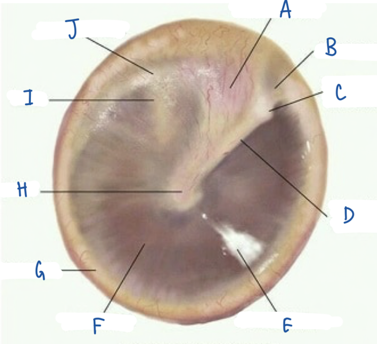 <p>What part of the tympanic membrane is labeled E?</p>