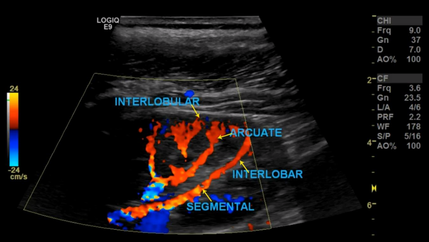 <ul><li><p>An arbor-like network of vessels coursing throughout the kidney</p></li><li><p>Once the renal artery enters the kidney it divides into</p><ul><li><p>Segmental arteries (usually 5)</p></li><li><p>Interlobar arteries</p></li><li><p>Arcuate arteries </p></li><li><p>Interlobular arteries</p></li></ul></li></ul><p></p>