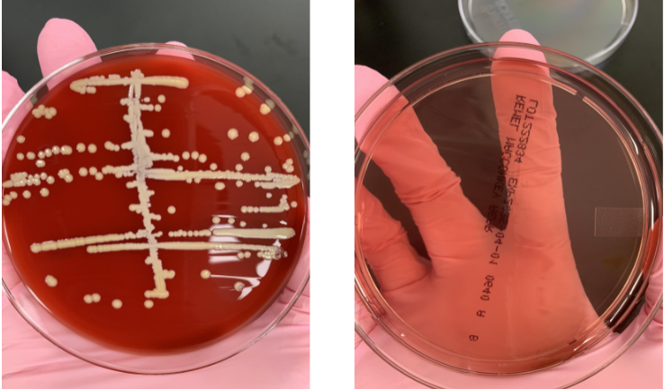 <p>if your catalse is (+) and coagulase is (-) what would the organism be</p>