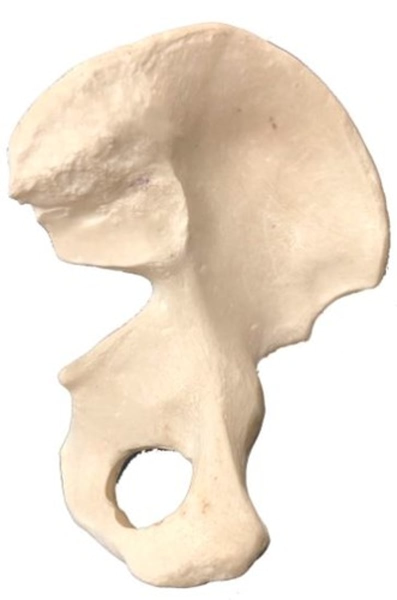 <p>Identify this bone.</p>