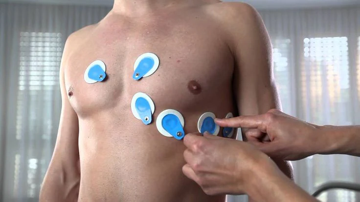 <p>It records the <strong>electrical activity of the heart</strong> by detecting electrical potentials across the whole heart.</p><ul><li><p>its recorded by placing <strong>electrodes on the limbs (limb leads)</strong> and/or <strong>on the chest (precordial leads)</strong>.</p></li><li><p>its purpose is to monitor cardiac function and detect <strong>homeostatic balance or cardiac pathologies</strong> based on characteristic waveforms.</p></li></ul><p></p>