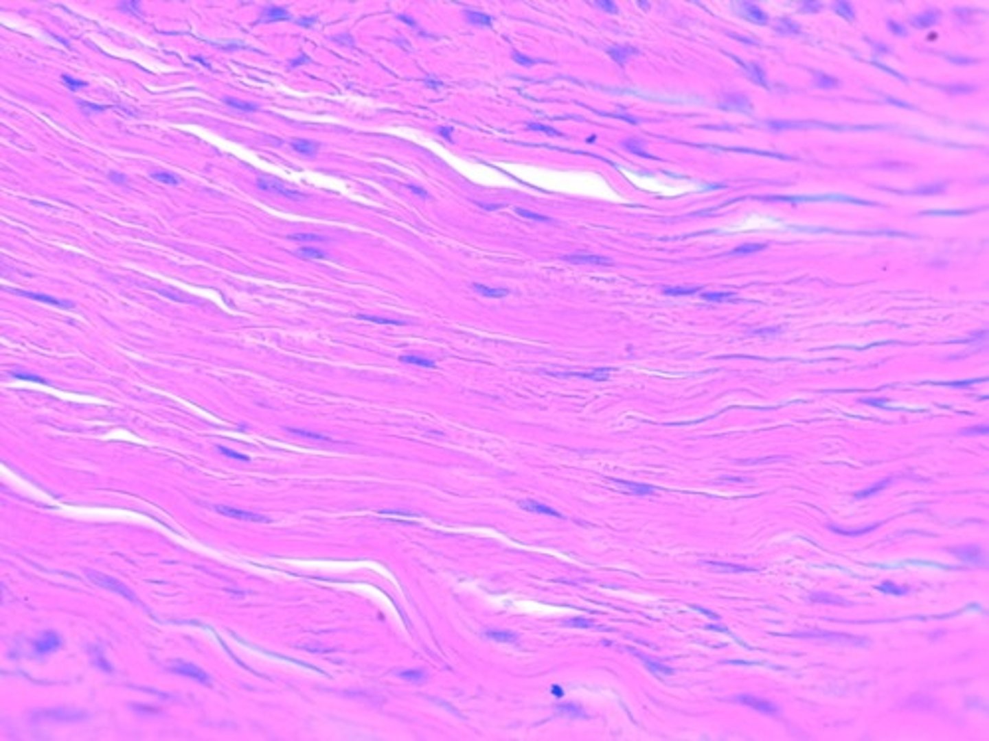 <p>Fibroblast</p><p>Collagen fiber</p>