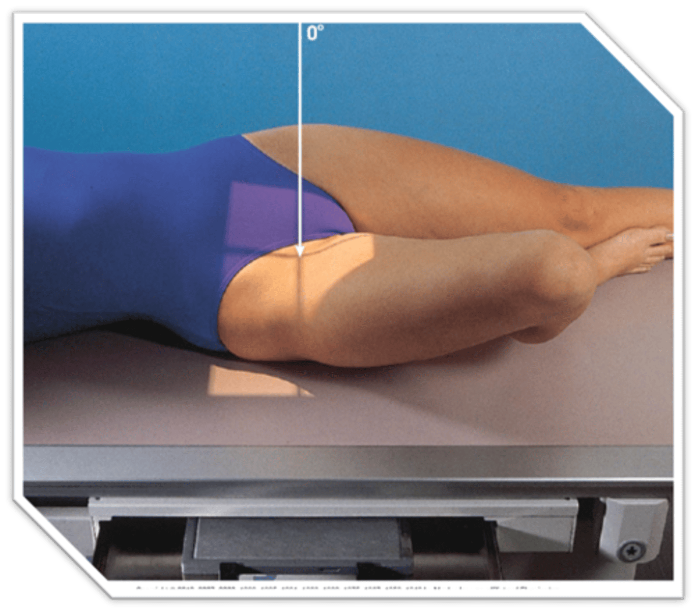 <p>CR perpendicular to the femoral neck. (1" superior to PS)</p>