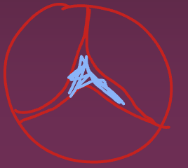 <ul><li><p>AR jet/LVOT area</p></li><li><p>AR jet height/LVOT height</p></li><li><p>AR Vena Contracta</p></li><li><p>AR PISA</p></li></ul>
