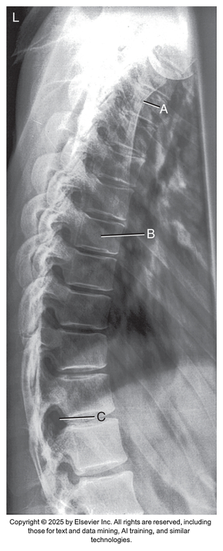 <p>What anatomical structure is letter C?</p>