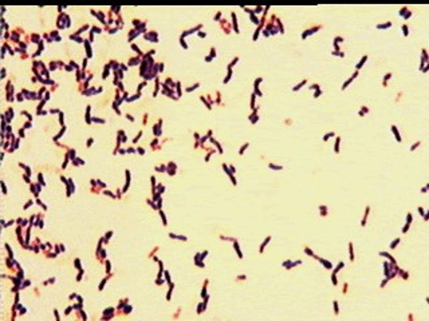 <p>The following image is an example of ________ shaped bacteria with __________ arrangement<br>a. coccus, clustered<br>b. bacillus, palisade<br>c. rod, chain liked<br>d. coccus, chain liked</p>