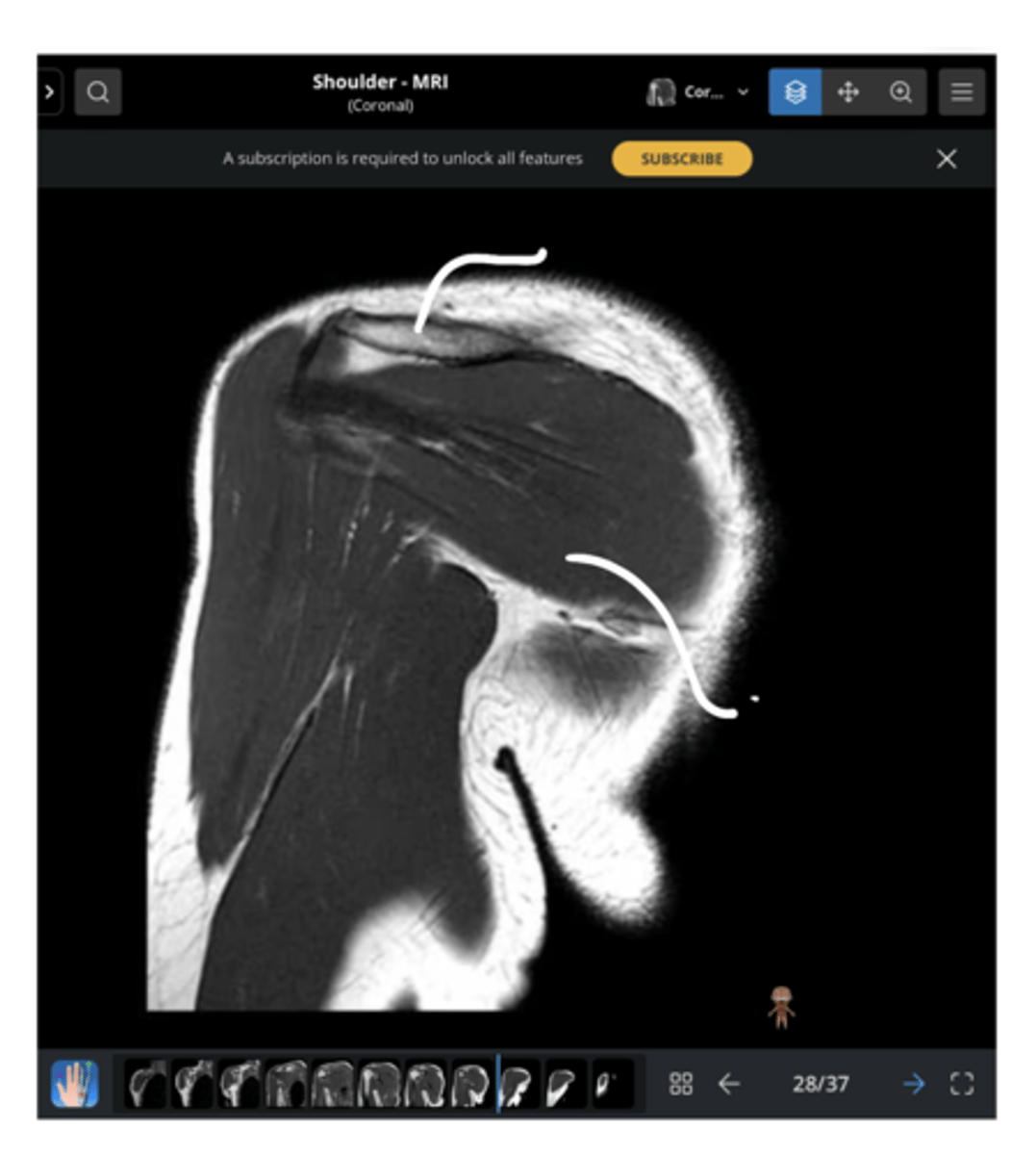 <p>1. What view is this image?</p><p>2. How do you know?</p><p>3. Which structures are being pointed to?</p>