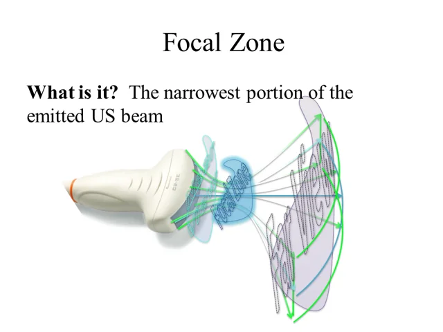 The region of the image at which the ultrasound beam is the narrowest (where lateral resolution is the best).