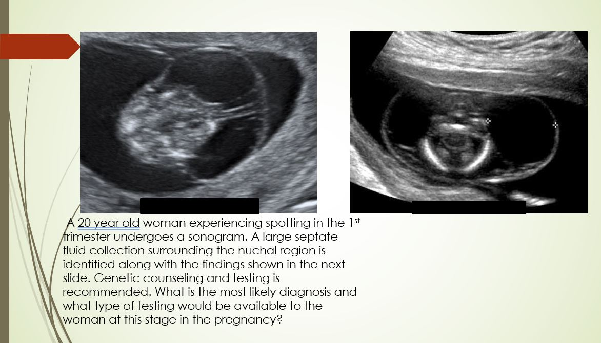 <p>What condition is seen the nuchal region and what testing would be done? A large septate fluid collection is seen in a first trimester scan.</p>