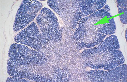 <p><span>The light area indicated by the green arrow is the</span><br><span><strong>germinal center</strong> of a lymphatic nodule.</span></p>