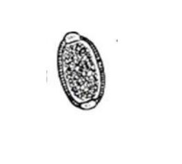<p><em>Capillaria phippinenses</em></p>