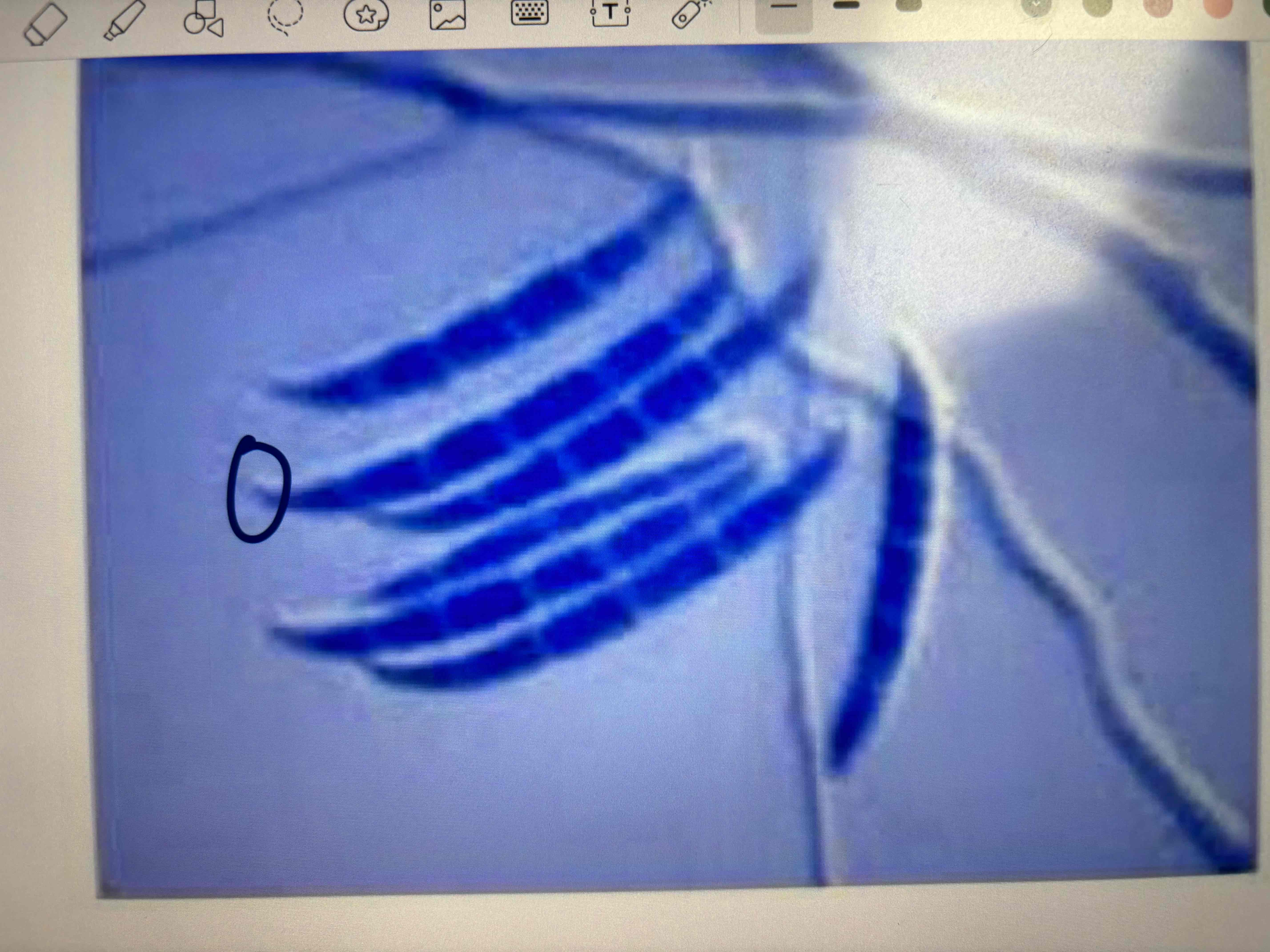 <p>Porosporas</p>