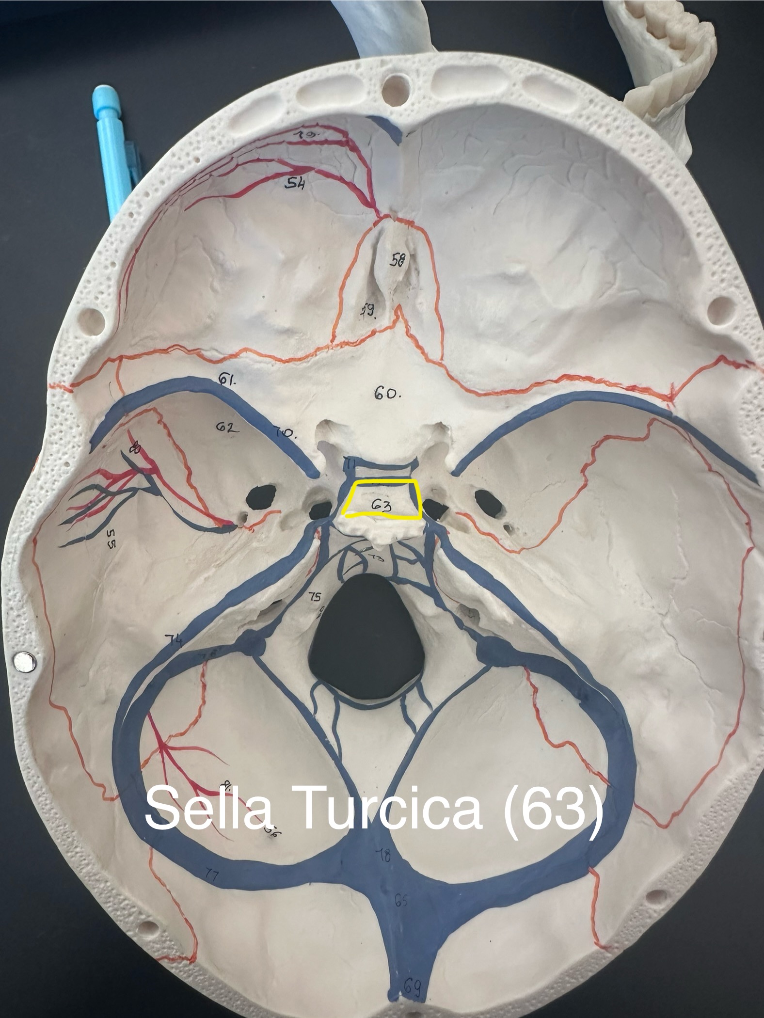 <p>Sella Turcica</p>