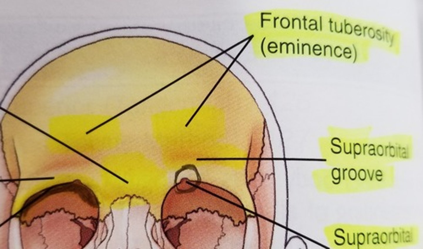 <p>C) supraorbital groove</p><p>pg. 378: the supraorbital groove is the slight depression above each eyebrow</p>