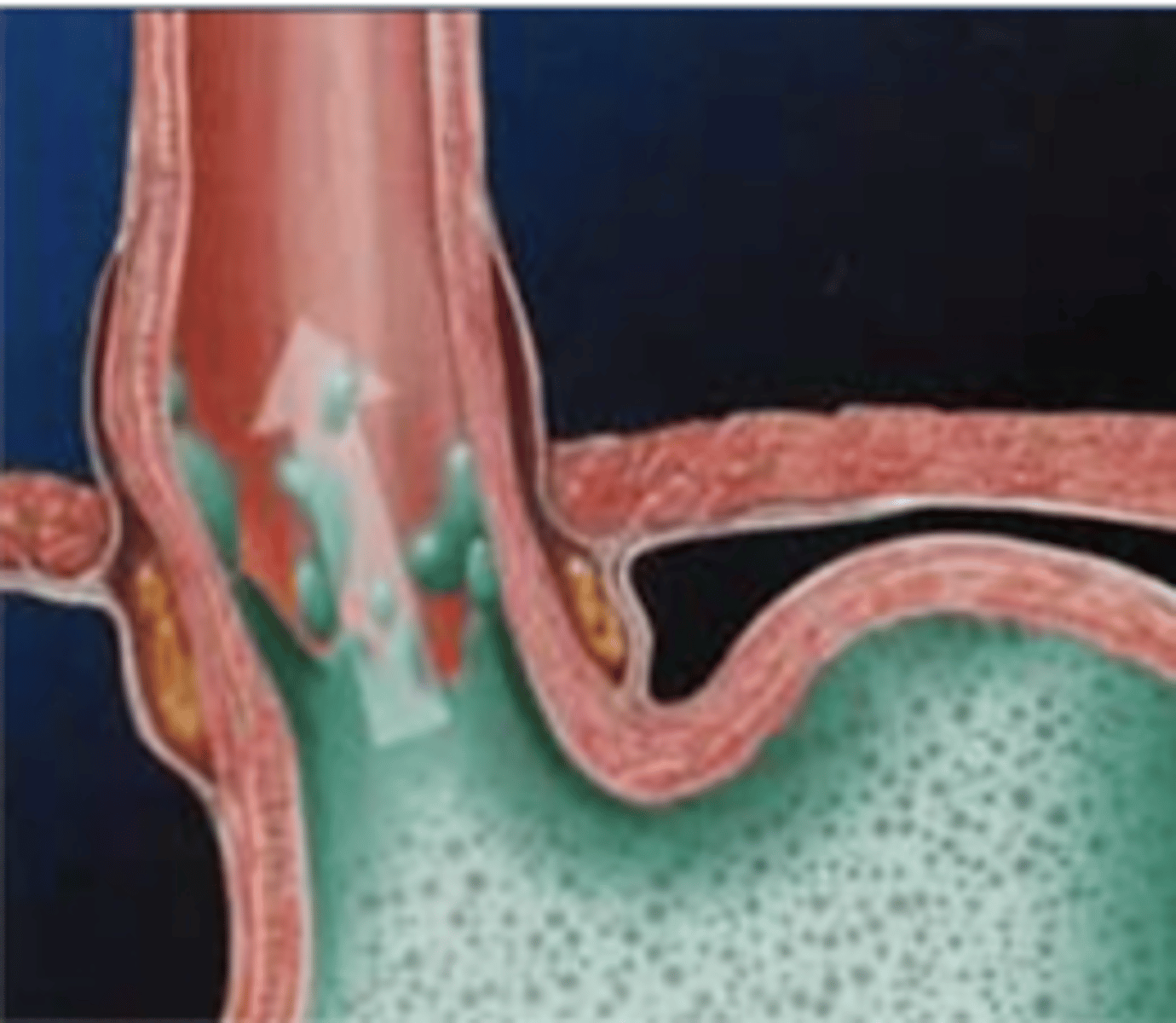 <p>what type of disorder is characterized here?</p>