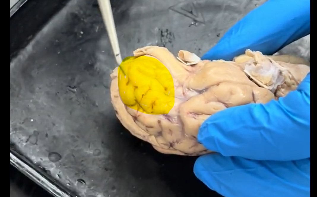 <p>Name the part of the brain at the tip of the probe and highlighted in yellow.</p>