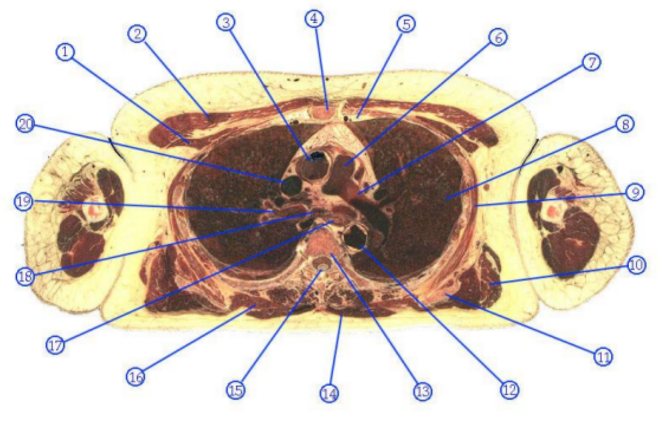 <p>What is structure 13?</p>