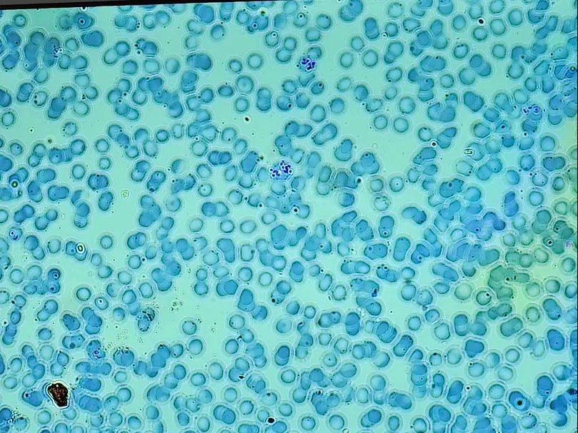 <p><span data-name="microscope" data-type="emoji">🔬</span><span data-name="petri_dish" data-type="emoji">🧫</span><strong><span> </span>Na podstawie zdjęcia preparatu:</strong></p><p></p><ul><li><p><span data-name="book" data-type="emoji">📖</span><span> </span>rozpoznaj gatunek pasożyta;</p></li></ul><p></p><ul><li><p><span data-name="recycle" data-type="emoji">♻</span><span> </span>rozpoznaj wszystkie formy rozwojowe;</p></li></ul><p></p><ul><li><p><span data-name="microbe" data-type="emoji">🦠</span><span> </span>wskaż organelle i cechy charakterystyczne dla danego gatunku;</p></li></ul><p></p><ul><li><p><span data-name="mask" data-type="emoji">😷</span><span> </span>nazwij chorobę, którą pasożyt wywołuje.</p></li></ul><p></p>