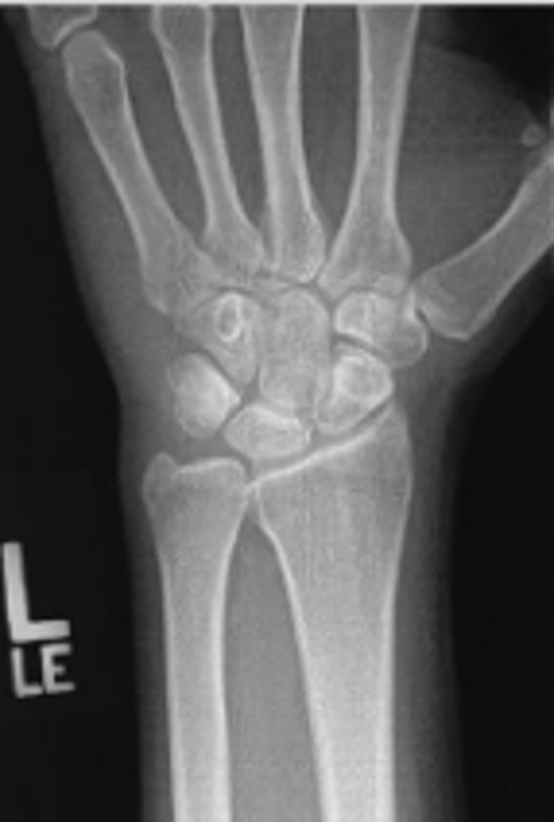 <p>What is the name of the radiographic view?</p>