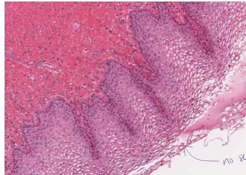 <p>stratified squamous epithelial, non-keratinized</p>