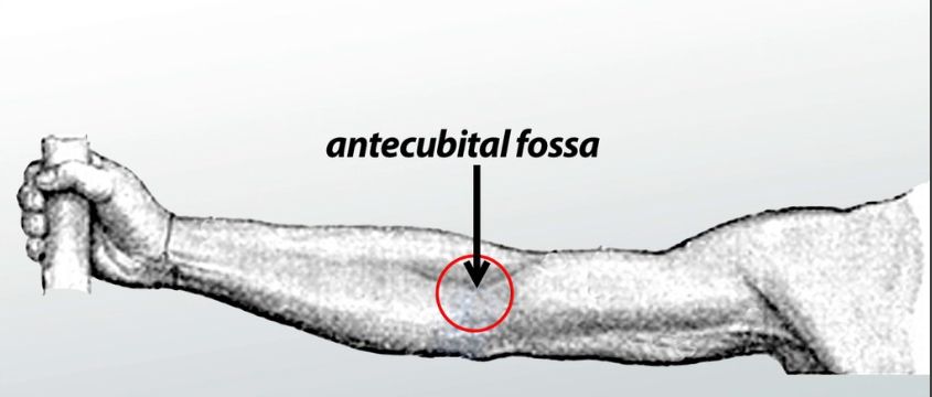 <p>anterior; Referring to the area in front of the elbow joint.</p>
